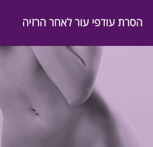 הסרת עודפי עור