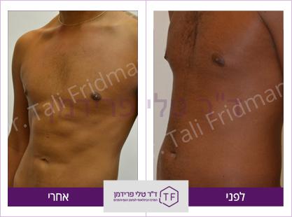 וייזר (1)