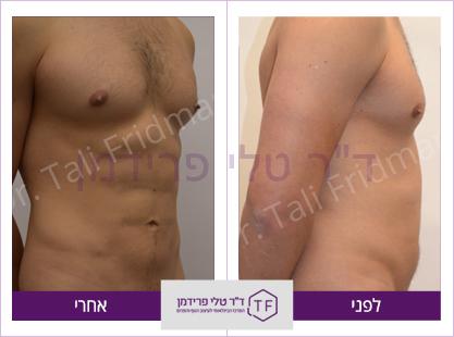 וייזר (2)